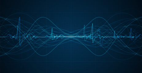 FREQUENCY STABILITY
